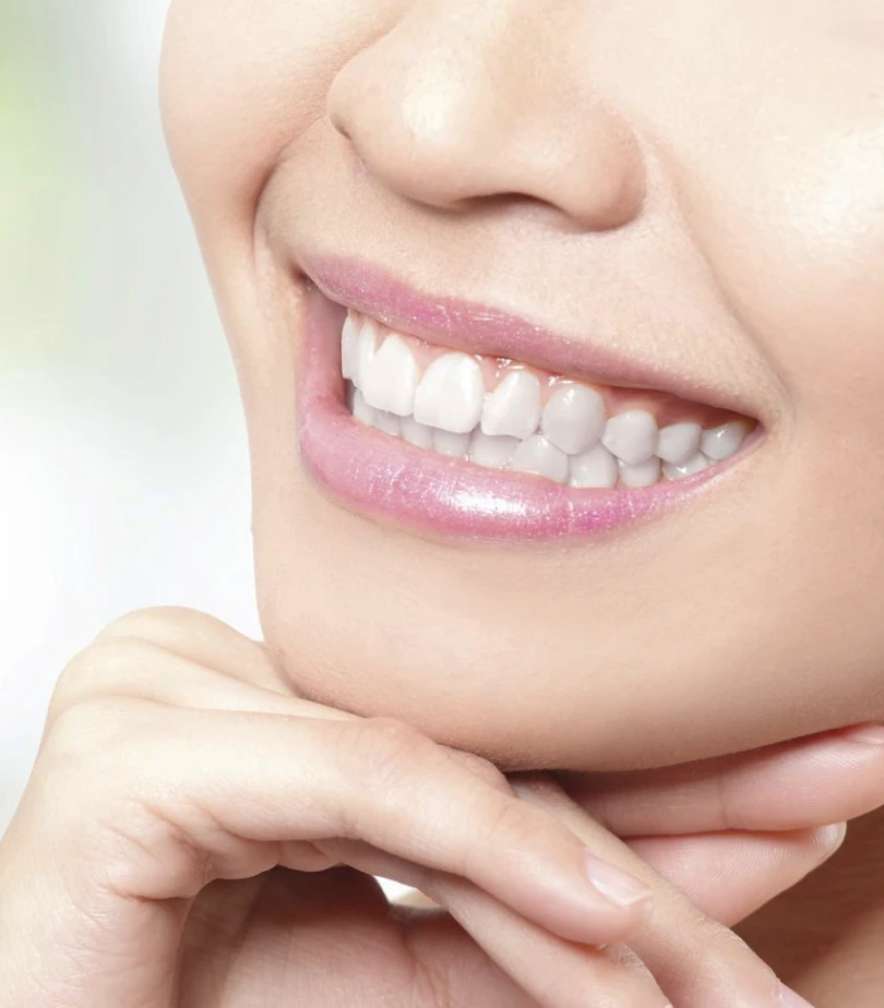 Impianti dentali senza viti