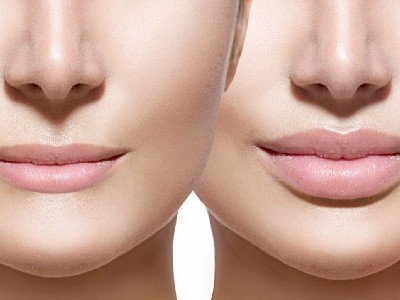 Lepotni tretmaji obraza